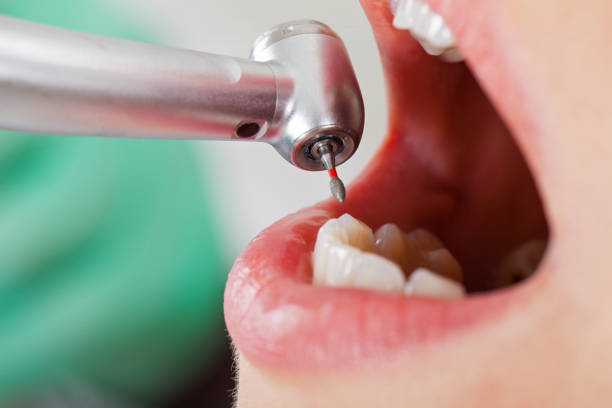 Best Emergency Treatment for Dental Infections or Abscesses in Wells, NV